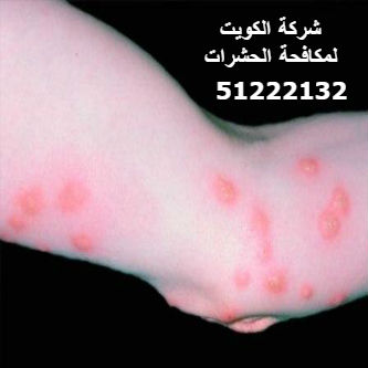 حشرات